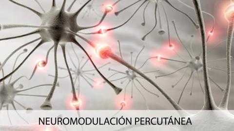 Evidencia Neuromodulacion Percutanea